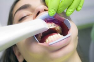 Read more about the article ¿Cuándo debe ser la primera visita del niño al dentista?